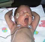 Anne-003-2-12-03