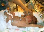 Catherine-getting-weighed